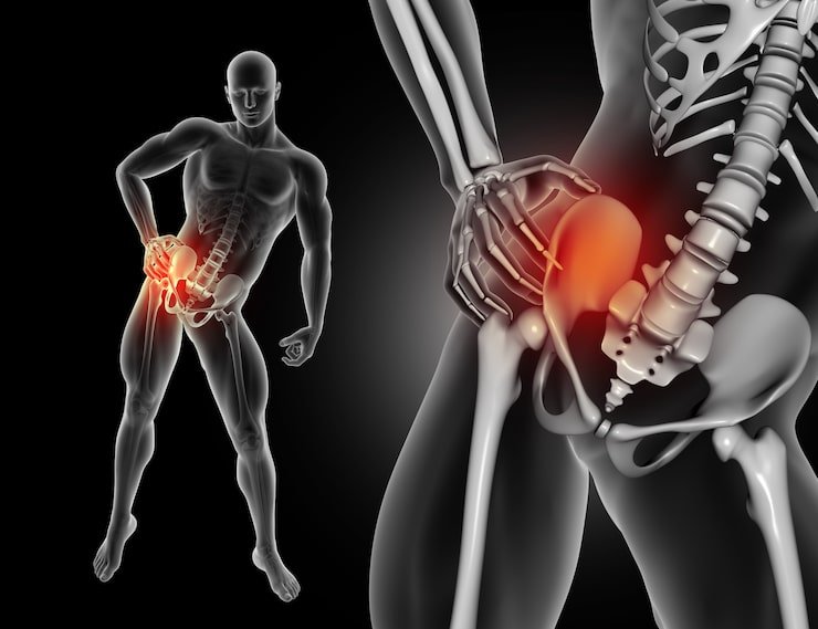 Knee Replacement Clinic in New Delhi | Care