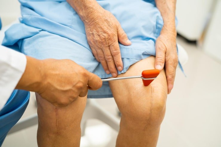 Knee Replacement Clinic in New Delhi | Care