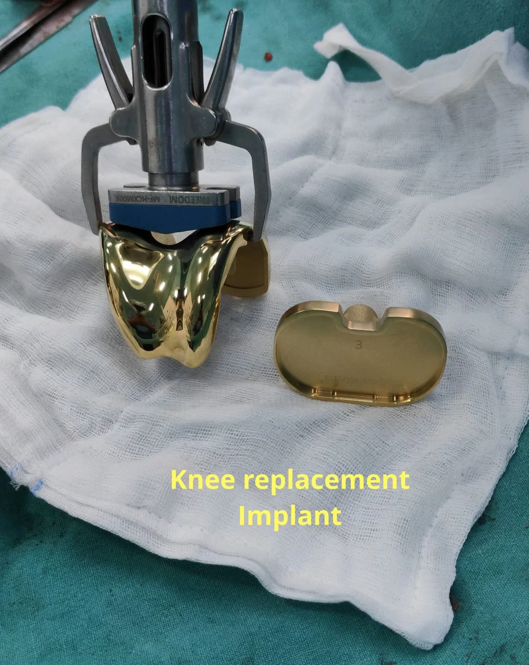Implants Used in Surgery