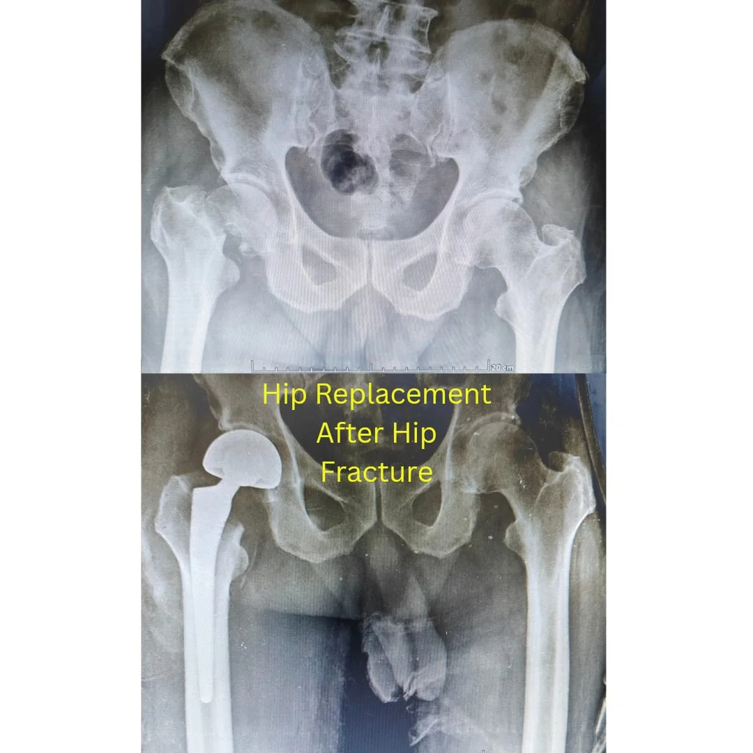 X-Ray Results