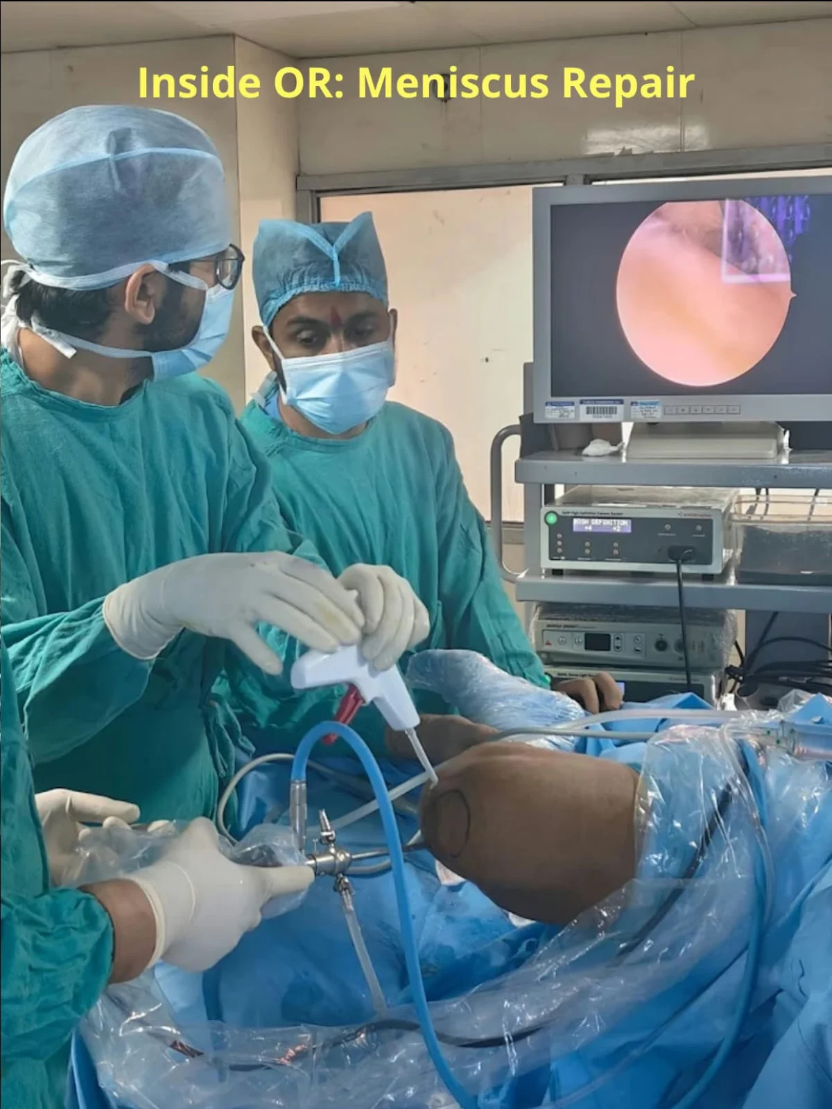 Meniscus Repair Surgery