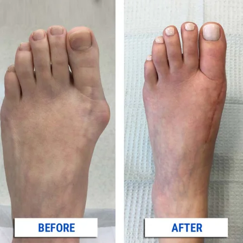 Orthopaedic Deformities
