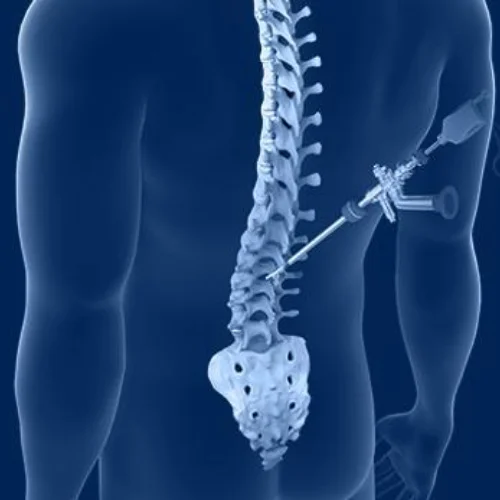 Spine Surgery